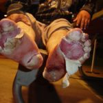 Una muestra de los estragos causados en los pies de este migrante después de caminar largas distancias en el desierto. Foto: Cortesía CBP